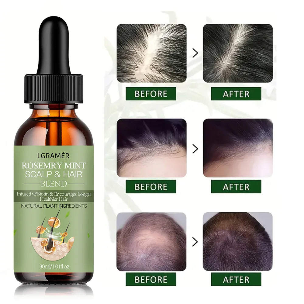Hair Growth Oil Organic  Peppermint Rosemary Scalp Strengthening Oil Nourishing Care Anti-split Ends and Hair Loss Hair Oil Set